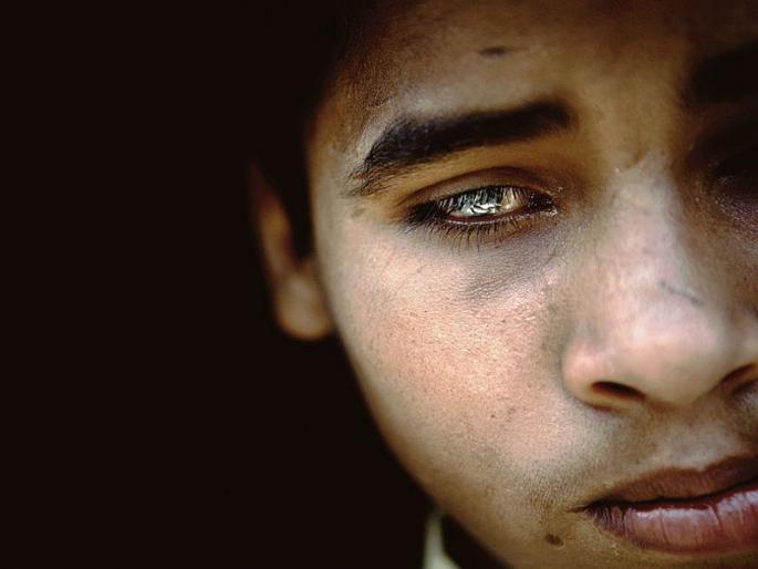 Five patients with blindness after surgery | शस्त्रक्रियेनंतर पाच रुग्णांना आले अंधत्व Five patients with blindness after surgery | शस्त्रक्रियेनंतर पाच रुग्णांना आले अंधत्व