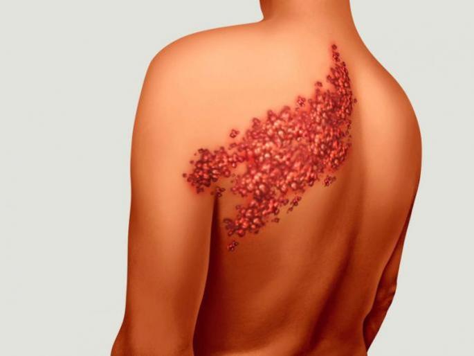 Early signs and symptoms of iron deficiency or anemia in girls and women causes risk factors diet | रक्ताच्या कमतरतेमुळे दिसून येतात 'ही' लक्षणं; दुर्लक्षं केलत तर होतील गंभीर परिणाम Early signs and symptoms of iron deficiency or anemia in girls and women causes risk factors diet | रक्ताच्या कमतरतेमुळे दिसून येतात 'ही' लक्षणं; दुर्लक्षं केलत तर होतील गंभीर परिणाम