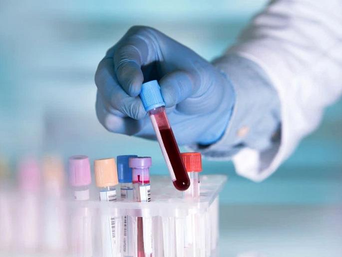 Why blood test on time to time? | वेळोवेळी Blood Test करत राहण्याचं कारण माहीत आहे का?