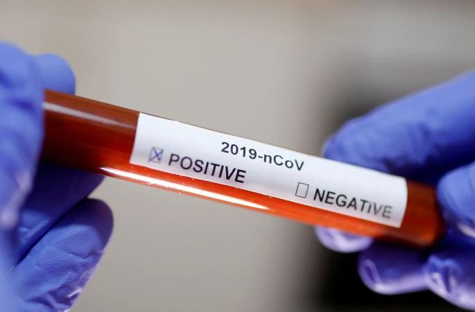 CoronaVirus: Six passengers returning to Buldana district from abroad tested positive | CoronaVirus : विदेशातून बुलडाणा जिल्ह्यात परतलेले सहा प्रवाशी पॉझिटिव्ह CoronaVirus: Six passengers returning to Buldana district from abroad tested positive | CoronaVirus : विदेशातून बुलडाणा जिल्ह्यात परतलेले सहा प्रवाशी पॉझिटिव्ह