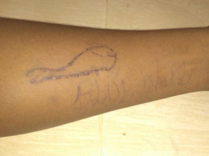 19-year-old man commits suicide due to blue whale, draws on his hand | ब्लू व्हेलच्या नादात 19 वर्षीय तरुणाची आत्महत्या, हातावर रेखाटलं होतं ब्लू व्हेलचं चित्र 19-year-old man commits suicide due to blue whale, draws on his hand | ब्लू व्हेलच्या नादात 19 वर्षीय तरुणाची आत्महत्या, हातावर रेखाटलं होतं ब्लू व्हेलचं चित्र