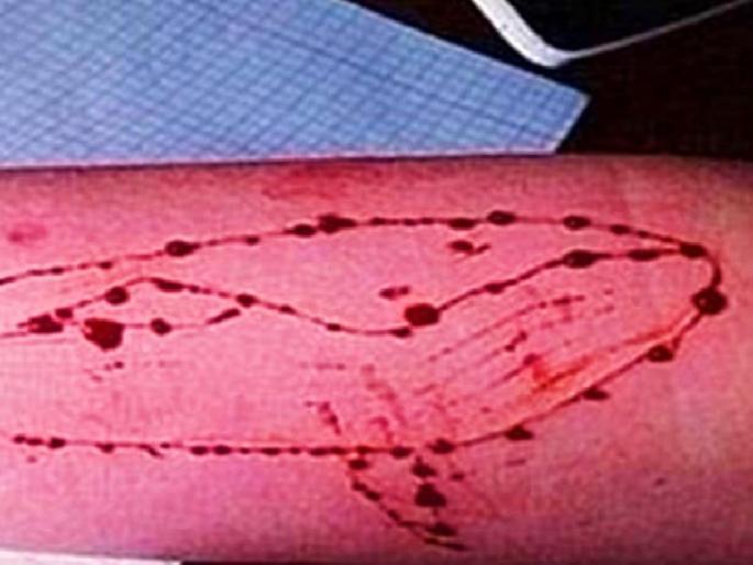 Remove all links to the Blue Whale Challenge | ब्ल्यू व्हेल चॅलेंजच्या सर्व लिंक काढा