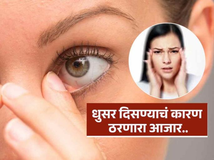 Expert says blurred vision can be a sign of diabetes, know symptoms | डोळ्यांनी कमी किंवा धुसर दिसतं? 'हा' गंभीर आजारही झालेला असू शकतो, पाहा लक्षणं