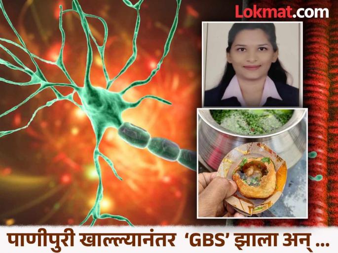 GBS outbreak After eating panipuri, a young woman developed GBS and died within a few days...' | GBS : 'पाणीपुरी खाल्ल्यानंतर ‘GBS’ झाला अन् काही दिवसातच तरुणीने जीव...' GBS outbreak After eating panipuri, a young woman developed GBS and died within a few days...' | GBS : 'पाणीपुरी खाल्ल्यानंतर ‘GBS’ झाला अन् काही दिवसातच तरुणीने जीव...'
