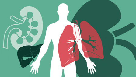 Multiple organ dysfunction, very serious illness ... know the symptoms | मल्टिपल ऑर्गन डिसफंक्शन, अत्यंत गंभीर आजार...जाणून घ्या लक्षणं