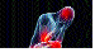 Mirage: Remedies on the way treatment of rheumatoid arthritis: Birth of the latest healing process | मिरज : संधिवाताचे रुग्ण वाढत असताना उपचार पद्धतीने दिलासा : अद्ययावत उपचार पद्धतीचा जन्म Mirage: Remedies on the way treatment of rheumatoid arthritis: Birth of the latest healing process | मिरज : संधिवाताचे रुग्ण वाढत असताना उपचार पद्धतीने दिलासा : अद्ययावत उपचार पद्धतीचा जन्म