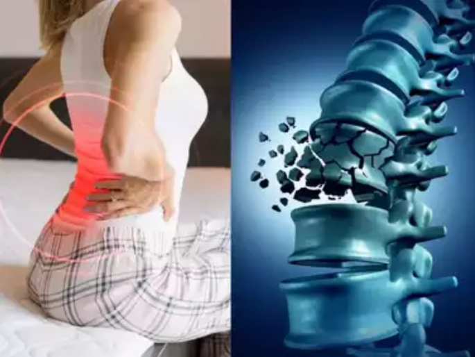Be careful, or the bones will be brittle; Wrong diet, lack of exercise is the cause | काळजी घ्या, नाही तर हाडे होतील ठिसूळ; चुकीचा आहार, व्यायामाचा अभाव ठरतोय कारणीभूत  Be careful, or the bones will be brittle; Wrong diet, lack of exercise is the cause | काळजी घ्या, नाही तर हाडे होतील ठिसूळ; चुकीचा आहार, व्यायामाचा अभाव ठरतोय कारणीभूत