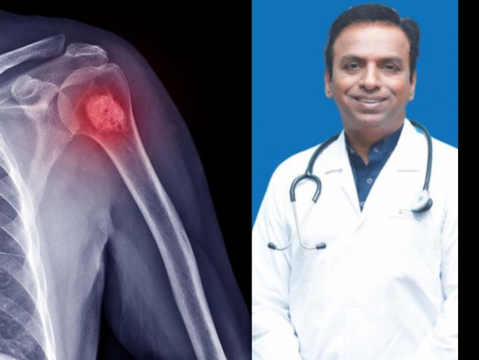 A second chance at life: Limb-saving surgery for children with bone cancer | जीवनाला दुसरी संधी: हाडांच्या कॅन्सरग्रस्त मुलांसाठी हात/पाय वाचवणारी शस्त्रक्रिया 