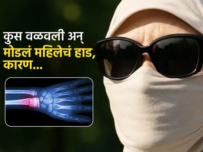 Woman over protection from sunlight to prevent tanning led to bone fracture | टॅनिंगपासून वाचण्यासाठी महिलेची 'ही' सवय पडली महागात, झोपेत कुशीवर वळली अन् मोडलं हाड...