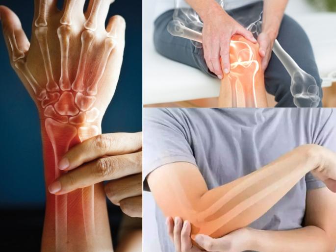 these habits are responsible for weak bones know about them more | Health tips: 'या' सवयी हाड कमकुवत करतात, वेळीच बदला अन्यथा होतील गंभीर आजार these habits are responsible for weak bones know about them more | Health tips: 'या' सवयी हाड कमकुवत करतात, वेळीच बदला अन्यथा होतील गंभीर आजार