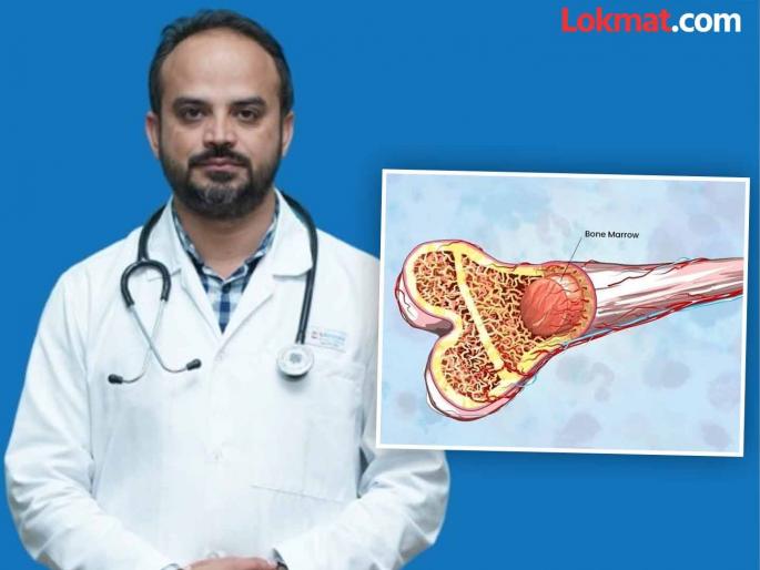The importance of bone marrow transplant in the treatment of rare blood disorders | दुर्मीळ रक्तविकारांवरील उपचारात बोन मॅरो ट्रान्स्प्लांटचे युग The importance of bone marrow transplant in the treatment of rare blood disorders | दुर्मीळ रक्तविकारांवरील उपचारात बोन मॅरो ट्रान्स्प्लांटचे युग