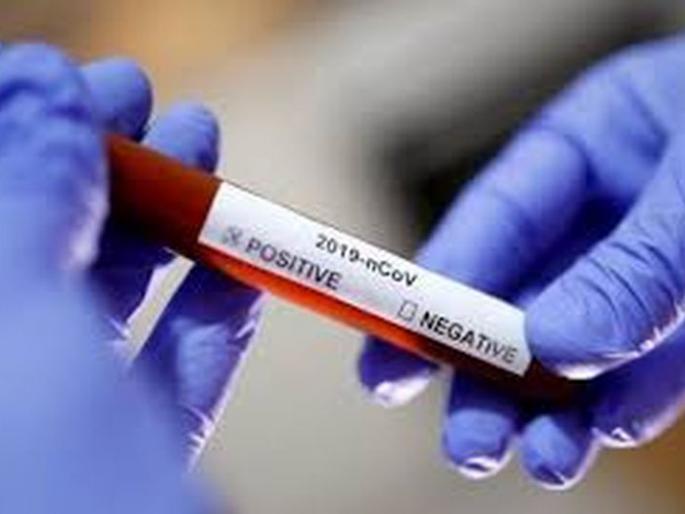 Six more positives in Washim district; Patient number 21! | CoronaVirus : वाशिम जिल्ह्यात आणखी सहा पॉझिटिव्ह; रुग्णसंख्या २१ ! Six more positives in Washim district; Patient number 21! | CoronaVirus : वाशिम जिल्ह्यात आणखी सहा पॉझिटिव्ह; रुग्णसंख्या २१ !