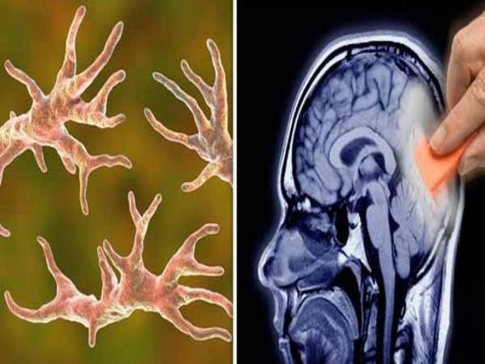 Texas girl fights life after contracting brain eating amoeba reports say | बापरे! 'अमिबा' खातोय 10 वर्षांच्या मुलीचा मेंदू; काय आहे, यामागील कारण?