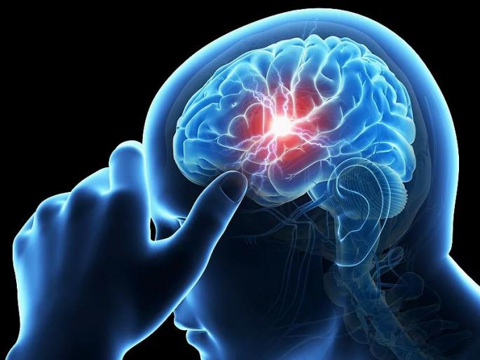 What is brain stroke problem? What are the symptoms? | का होते ब्रेन स्ट्रोकची समस्या? काय आहेत याची लक्षणे? What is brain stroke problem? What are the symptoms? | का होते ब्रेन स्ट्रोकची समस्या? काय आहेत याची लक्षणे?