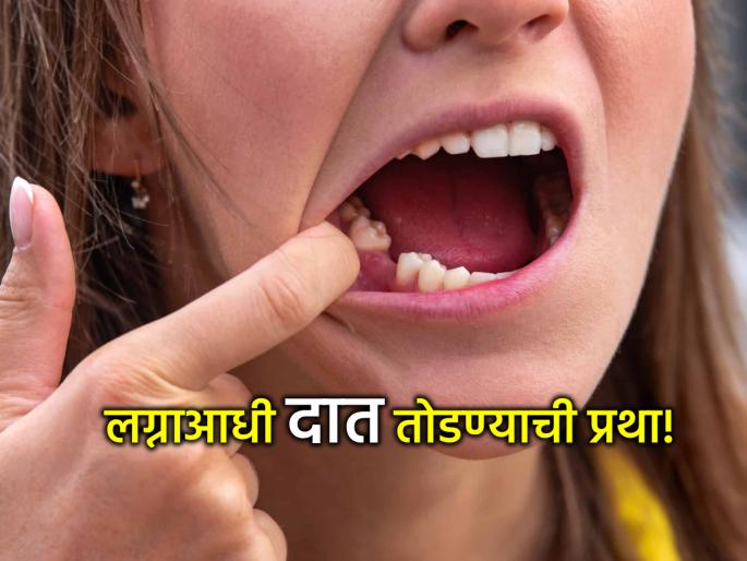 Jara Hatke: Strange custom: In 'this' village, the bride's teeth are broken before the wedding; but why??? Read | Jara Hatke: अजब प्रथा: 'या' गावात लग्नाआधी तोडले जातात वधूचे दात; पण का??? वाचा Jara Hatke: Strange custom: In 'this' village, the bride's teeth are broken before the wedding; but why??? Read | Jara Hatke: अजब प्रथा: 'या' गावात लग्नाआधी तोडले जातात वधूचे दात; पण का??? वाचा