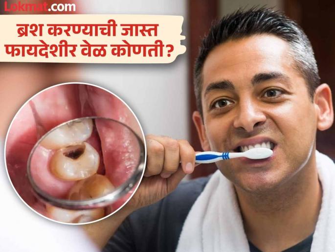 What is the best time to brush your teeth, know the right method | ब्रश करण्याची 'ही' आहे सगळ्यात बेस्ट वेळ; दातांचं दुखणं, पिवळेपणा अन् कीडही होईल दूर... What is the best time to brush your teeth, know the right method | ब्रश करण्याची 'ही' आहे सगळ्यात बेस्ट वेळ; दातांचं दुखणं, पिवळेपणा अन् कीडही होईल दूर...
