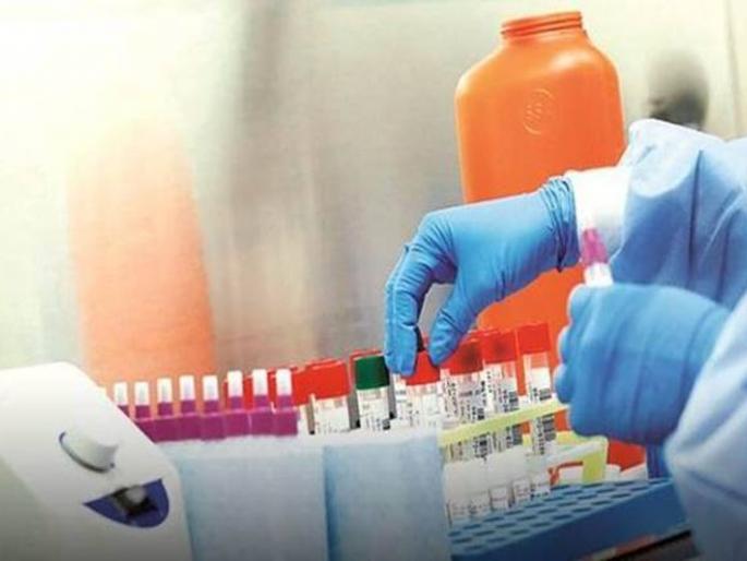 Buldana district leads in RTPCR test in West Vidarbha! | आरटीपीसीआर टेस्टमध्ये पश्चिम विदर्भात बुलडाणा जिल्हा आघाडीवर! Buldana district leads in RTPCR test in West Vidarbha! | आरटीपीसीआर टेस्टमध्ये पश्चिम विदर्भात बुलडाणा जिल्हा आघाडीवर!