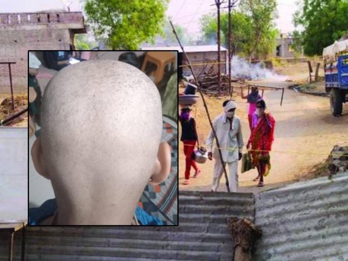 Villagers in Buldhana are shocked by an unknown disease, people are going bald in 3 days | अबब...! ३ दिवसातच पडतंय टक्कल; अज्ञात आजारानं गावकरी हैराण, आरोग्य विभाग अलर्ट Villagers in Buldhana are shocked by an unknown disease, people are going bald in 3 days | अबब...! ३ दिवसातच पडतंय टक्कल; अज्ञात आजारानं गावकरी हैराण, आरोग्य विभाग अलर्ट