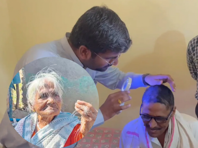 The reason for people's hair loss in Buldhana district has been revealed | बुलढाणा: ...म्हणून केस गळू लागले, टक्कल पडण्याचे धक्कादायक कारण आले समोर The reason for people's hair loss in Buldhana district has been revealed | बुलढाणा: ...म्हणून केस गळू लागले, टक्कल पडण्याचे धक्कादायक कारण आले समोर