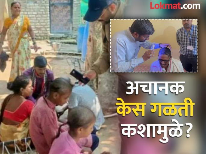 Is water the cause of hair loss Baldness in 11 villages Anti-fungal clinical examination of citizens begins | तीन दिवसांत टक्कल पडण्यामागचं कारण पाणी?; १०० जणांची केस गळले, त्वचातज्ज्ञांना उलगडेना कोडे Is water the cause of hair loss Baldness in 11 villages Anti-fungal clinical examination of citizens begins | तीन दिवसांत टक्कल पडण्यामागचं कारण पाणी?; १०० जणांची केस गळले, त्वचातज्ज्ञांना उलगडेना कोडे