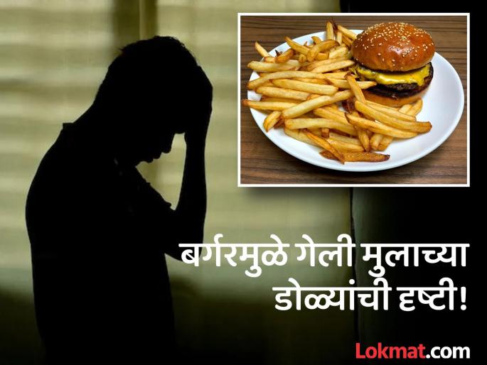 Boy to go permanently blind after eating junk food diet regularly | धक्कादायक! बर्गर-फ्राइज खाऊन 12 वर्षाच्या मुलाचे गेले डोळे, कारण जे तुम्हालाही माहीत असावं! Boy to go permanently blind after eating junk food diet regularly | धक्कादायक! बर्गर-फ्राइज खाऊन 12 वर्षाच्या मुलाचे गेले डोळे, कारण जे तुम्हालाही माहीत असावं!