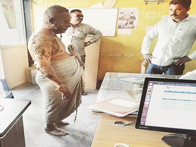 Shocking! trader burnt by using petrol through a money dispute | पैशाच्या वादातून व्यापाऱ्याला पेट्रोल टाकून जाळले; पेटलेल्या अवस्थेतच गाठले ठाणे Shocking! trader burnt by using petrol through a money dispute | पैशाच्या वादातून व्यापाऱ्याला पेट्रोल टाकून जाळले; पेटलेल्या अवस्थेतच गाठले ठाणे