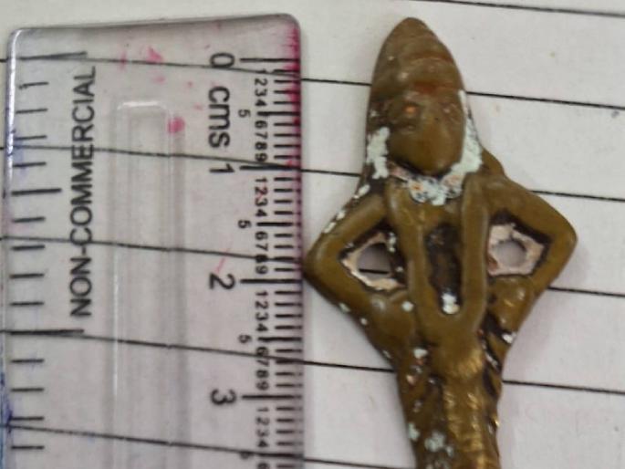 Idol of Vitthal surgically removed from leg; | शस्त्रक्रिया करून पायातून काढली विठ्ठलाची मूर्ती; ठाणे जिल्हा सामान्य रुग्णालयात पार पडली शस्त्रक्रिया Idol of Vitthal surgically removed from leg; | शस्त्रक्रिया करून पायातून काढली विठ्ठलाची मूर्ती; ठाणे जिल्हा सामान्य रुग्णालयात पार पडली शस्त्रक्रिया