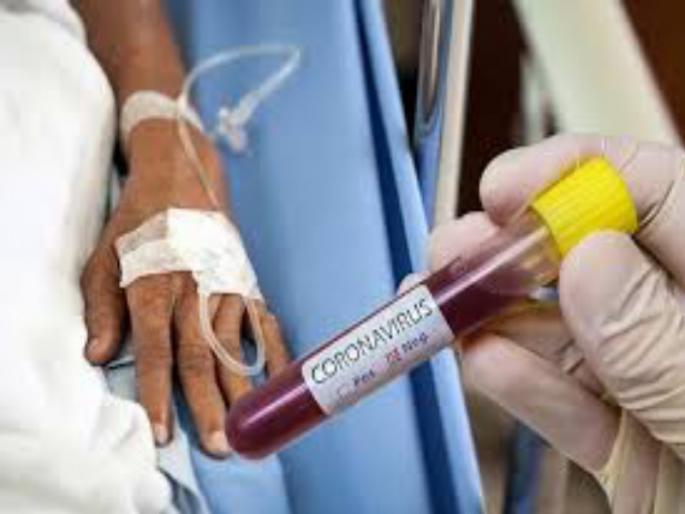 Corona virus : Number of corona positive patients in Pune district is 16 thousand; So far 604 patients have died | Corona virus : पुणे जिल्ह्यात कोरोना पॉझिटिव्ह रूग्णांची संख्या १६ हजारांच्या घरात; आतापर्यंत ६०४ रुग्णांचा मृत्यू Corona virus : Number of corona positive patients in Pune district is 16 thousand; So far 604 patients have died | Corona virus : पुणे जिल्ह्यात कोरोना पॉझिटिव्ह रूग्णांची संख्या १६ हजारांच्या घरात; आतापर्यंत ६०४ रुग्णांचा मृत्यू