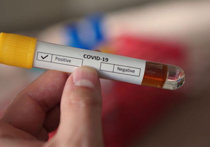 Minimum 'Covid test' in Wardha district | तापाने फणफणणाऱ्या वर्धा जिल्ह्यात ‘कोविड टेस्ट’ नाममात्रच!