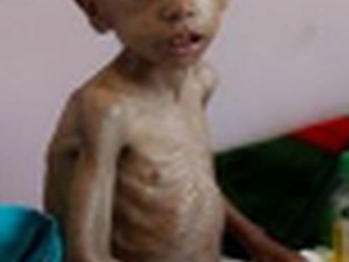 162 children of the district were malnourished | जिल्ह्यातील १६२ बालक झाले कुपोषणमुक्त 162 children of the district were malnourished | जिल्ह्यातील १६२ बालक झाले कुपोषणमुक्त