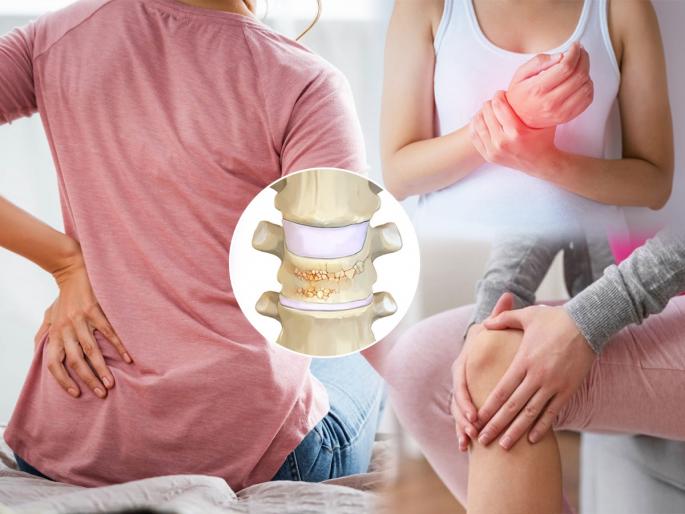 World Osteoporosis Day 2022 : 4 Diet Rules To Avoid Brittle Bones...Prevent Osteoporosis In Time | World Osteoporosis Day 2022 : हाडे ठिसूळ होऊ नयेत म्हणून आहाराबाबत ४ नियम...झीज वेळेत टाळा