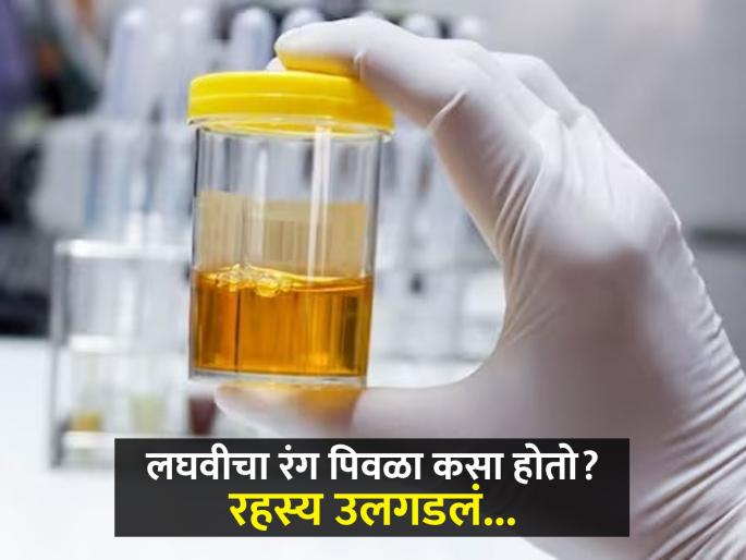 How does urine turn yellow? Scientists have been wondering the answer for many years, now we know the reason... | लघवीचा रंग पिवळा कसा होतो? अनेक वर्षांपासून वैज्ञानिक शोत होते उत्तर, आता समजलं कारण...