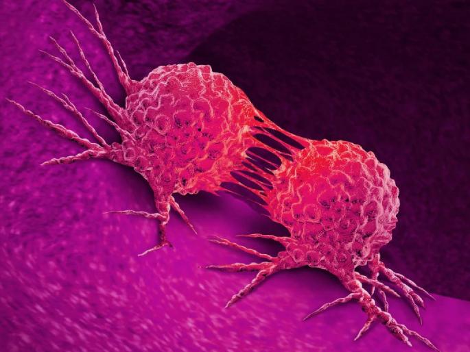 Official count to govern cancer patients; Health department proposal prepared | कॅन्सर रुग्णांची शासन करणार अधिकृत मोजदाद; आरोग्य विभागाचा प्रस्ताव तयार Official count to govern cancer patients; Health department proposal prepared | कॅन्सर रुग्णांची शासन करणार अधिकृत मोजदाद; आरोग्य विभागाचा प्रस्ताव तयार