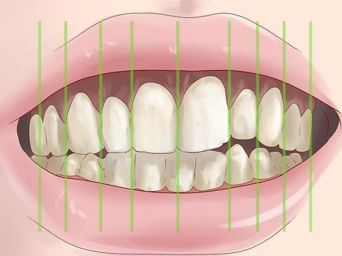 Cancer Check, Multiple Government Employees | कर्करोग तपासणी, अनेक शासकीय कर्मचा-यांचे ‘मुख अस्वास्थ’ Cancer Check, Multiple Government Employees | कर्करोग तपासणी, अनेक शासकीय कर्मचा-यांचे ‘मुख अस्वास्थ’