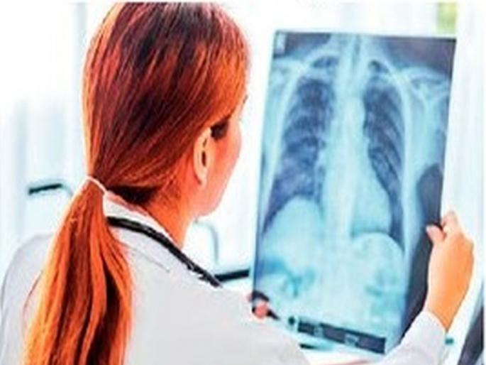 Lung cancer rates are increasing rapidly among women, pollution is the major reason | महिलांमध्ये झपाट्याने वाढतेय फुप्फुसाच्या कर्करोगाचे प्रमाण, प्रदूषण हेच मोठे कारण Lung cancer rates are increasing rapidly among women, pollution is the major reason | महिलांमध्ये झपाट्याने वाढतेय फुप्फुसाच्या कर्करोगाचे प्रमाण, प्रदूषण हेच मोठे कारण