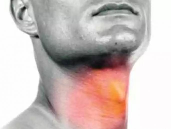 four patients a month have cancer of the larynx In Kolhapur district | कोल्हापूर जिल्ह्यात महिन्याला चार रुग्णांना स्वरयंत्राचा कर्करोग, 'या' लक्षणांकडे करू नका दुर्लक्ष  four patients a month have cancer of the larynx In Kolhapur district | कोल्हापूर जिल्ह्यात महिन्याला चार रुग्णांना स्वरयंत्राचा कर्करोग, 'या' लक्षणांकडे करू नका दुर्लक्ष