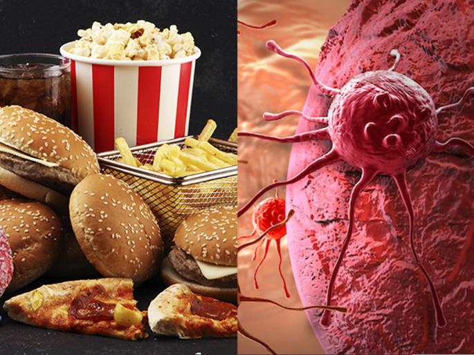 doctor reveals reasons for cancer in young people cancer rising rapidly in people under 40's doctor reveals 5 reasons | ऐन चाळिशीत कँसर होण्याची ५ प्रमुख कारणं! दिवसभरात करताय 'या' चुका - दुर्लक्ष करणं पडू शकतं महागात... doctor reveals reasons for cancer in young people cancer rising rapidly in people under 40's doctor reveals 5 reasons | ऐन चाळिशीत कँसर होण्याची ५ प्रमुख कारणं! दिवसभरात करताय 'या' चुका - दुर्लक्ष करणं पडू शकतं महागात...