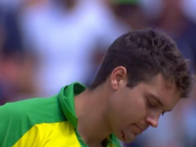 Australia Vs England World Cup Semi Final : Alex Carey has been hit on the chin by Jofra Archer and he has small yet bleeding gnash on the chi | Australia Vs England World Cup Semi Final : अ‍ॅलेक्स केरीच्या जबड्यावर चेंडू आदळला अन् रक्त वाहू लागले