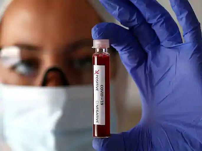 Accurate diagnosis of corona will be made in just an hour | दिलासादायक : ‘फेलुदा’ पेपर टेस्टला परवानगी,अवघ्या तासाभरात होणार कोरोनाचे अचूक निदान Accurate diagnosis of corona will be made in just an hour | दिलासादायक : ‘फेलुदा’ पेपर टेस्टला परवानगी,अवघ्या तासाभरात होणार कोरोनाचे अचूक निदान