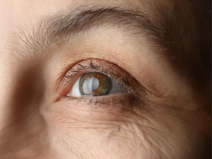 Got a cataract? Free operation till March 4; Aim to perform 1 lakh surgeries in a fortnight | मोतीबिंदू झालाय? ४ मार्चपर्यंत मोफत ऑपरेशन; पंधरवड्यात १ लाख शस्त्रक्रिया करण्याचे लक्ष्य Got a cataract? Free operation till March 4; Aim to perform 1 lakh surgeries in a fortnight | मोतीबिंदू झालाय? ४ मार्चपर्यंत मोफत ऑपरेशन; पंधरवड्यात १ लाख शस्त्रक्रिया करण्याचे लक्ष्य