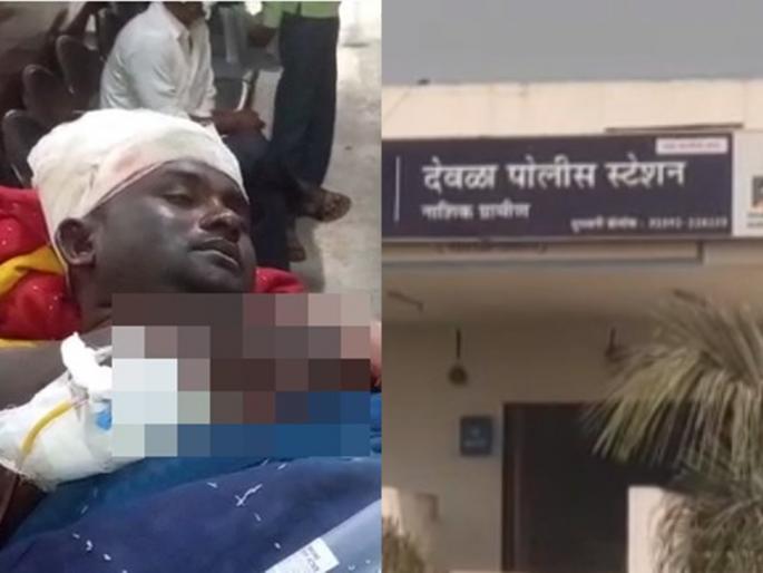 petrol was thrown on the body of the lover and burnt, the family including the girl in nashik | धक्कादायक! प्रियकरालाच अंगावर पेट्रोल टाकून जाळले, युवतीसह कुटुंबीय ताब्यात petrol was thrown on the body of the lover and burnt, the family including the girl in nashik | धक्कादायक! प्रियकरालाच अंगावर पेट्रोल टाकून जाळले, युवतीसह कुटुंबीय ताब्यात