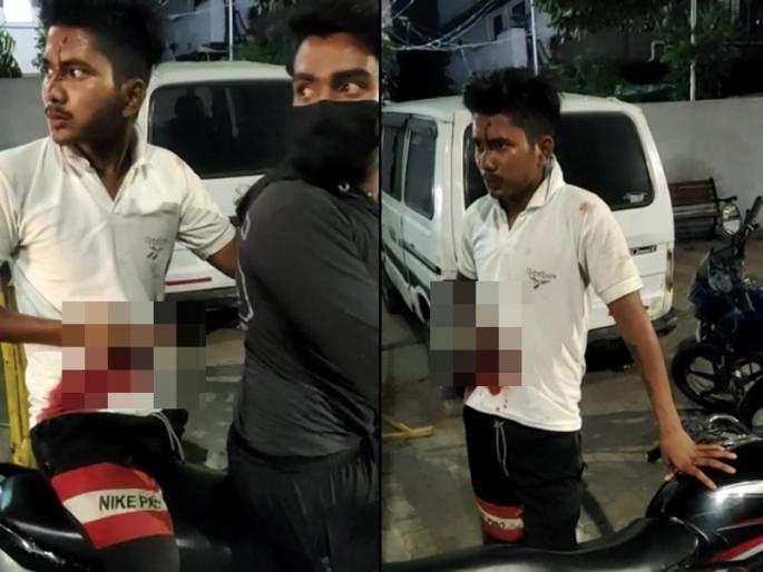 ... He reached the police station with a knife in his stomach in nagpur crime news | ... तो पोटात चाकू घेऊन पोहचला पोलीस ठाण्यात, बघाबघीवरुन झाला वाद ... He reached the police station with a knife in his stomach in nagpur crime news | ... तो पोटात चाकू घेऊन पोहचला पोलीस ठाण्यात, बघाबघीवरुन झाला वाद