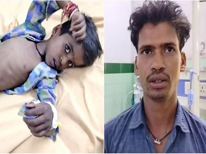 Chimkulya was beaten and teeth knocked out as Bhandara came to eat in Bareli | भंडारा जेवायला आला म्हणून चिमकुल्यास मारहाण, दात पाडले Chimkulya was beaten and teeth knocked out as Bhandara came to eat in Bareli | भंडारा जेवायला आला म्हणून चिमकुल्यास मारहाण, दात पाडले