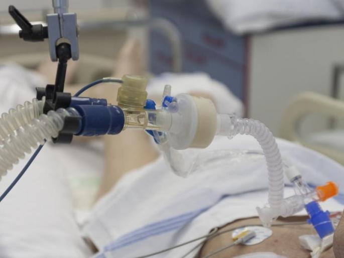 Suspicion that states are hiding the death toll, the court ordered | राज्ये मृतांची संख्या लपवत असल्याची शंका, सुप्रीम कोर्टाचे महत्त्वाचे निर्देश