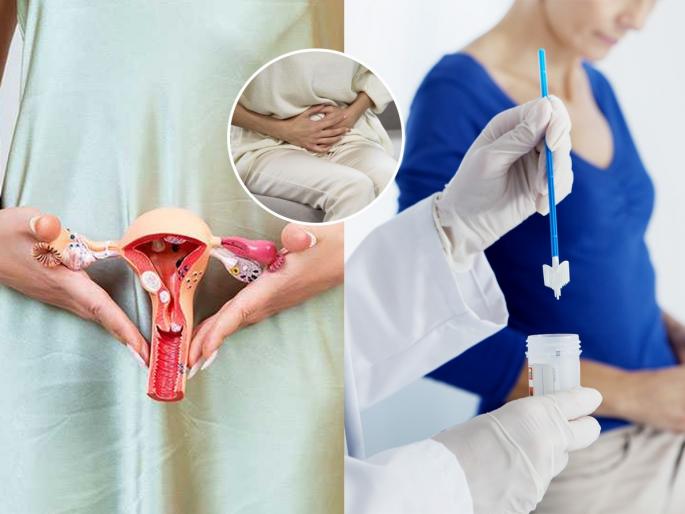 what is the right age for cervical cancer screening test  | सर्व्हायकल कॅन्सरची तपासणी करणं कोणत्या वयात जास्त गरजेचं? लक्षणं कोणती- आजार कसा ओळखायचा?