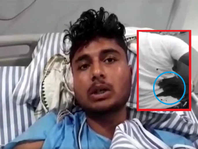 Nupur Sharma Controversy: Bihar boy allegedly stabbed over whastApp post supporting Nupur Sharma | Nupur Sharma Controversy: नुपुर शर्माची पोस्ट का पाहतोस..? असे म्हणत तरुणाला चाकुने भोसकले, प्रकृती नाजुक