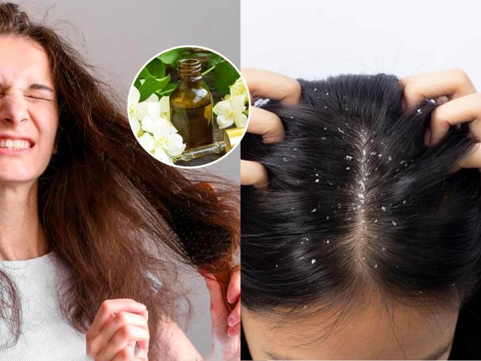 How to use jasmine flower oil for dry and falling hair dandruff Dry hair solution Ayurvedic treatment for hair fall | केस आहे की खराटा? गळणाऱ्या-ड्राय केसांना लावा ‘या’ पांढऱ्या फुलाचं तेल-सोपा उपाय