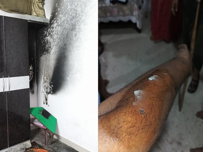 Electric charging battery explodes, two injured | इलेक्ट्रिक चार्जिंग बॅटरीचा स्फोट, दोघे जखमी Electric charging battery explodes, two injured | इलेक्ट्रिक चार्जिंग बॅटरीचा स्फोट, दोघे जखमी