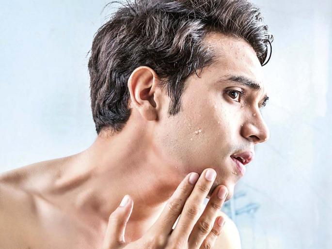 pimples on the face, mood off, this might be a reason | चेहर्यावर पिंपल्स आलेत, चिडचिड होतेय, त्याचं हे कारण... pimples on the face, mood off, this might be a reason | चेहर्यावर पिंपल्स आलेत, चिडचिड होतेय, त्याचं हे कारण...