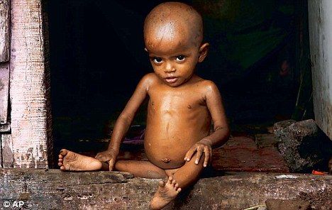 Treatment of 11,438 malnourished people in the district during the Corona period | कोरोनाकाळात जिल्ह्यात 11,438 कुपोषितांवर उपचार